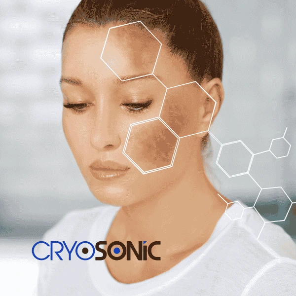 Are you looking for age spot removal treatment? Contact Cryosonic today in Dewsbury