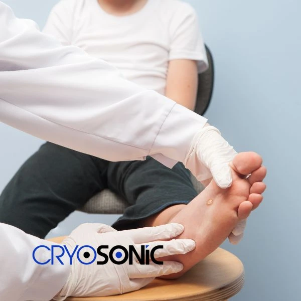 Are you looking for fast effective wart removal Contact us today Dewsbury