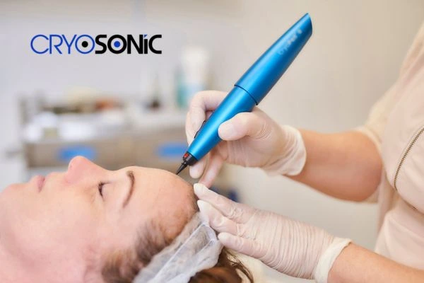 Treatment Timeline: What to Expect After Removal of a Wart or Skin Tag – Day 1 to Day 30 Dewsbury